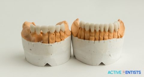 Common Dental Crown Problems And Solutions