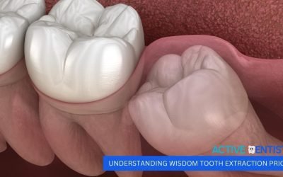 Understanding Wisdom Tooth Extraction Prices
