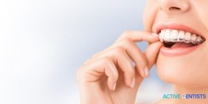 invisalign